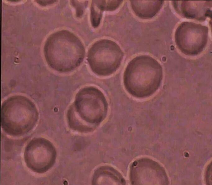 Červené krvinky EEsystem